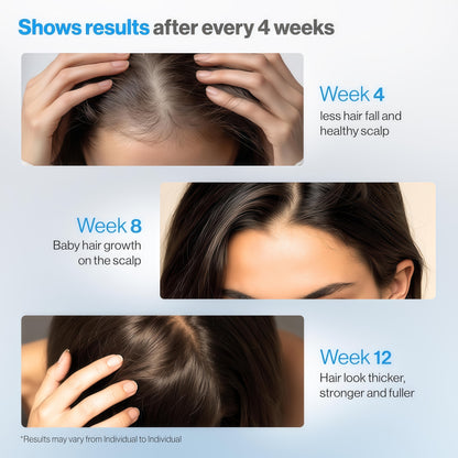 Rosemary Hair Growth Serum Roll On 25 ml – 3% Rosemary, 3% Redensyl & 2% Anagain | DHT-Blocking Scalp Serum Boosts Oxygen Flow, Reduces Hair Fall | Paraben/Sulfate-Free | Women & Men